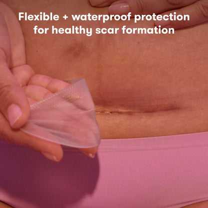 C-section Silicone Scar Patch